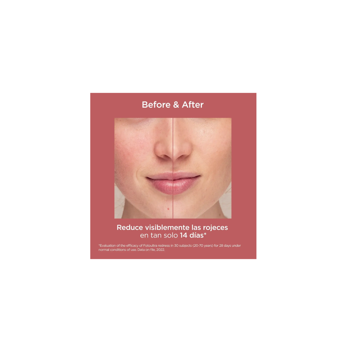 Isdin fotoultra redness 50 ml