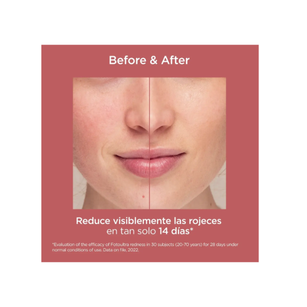 Isdin fotoultra redness 50 ml