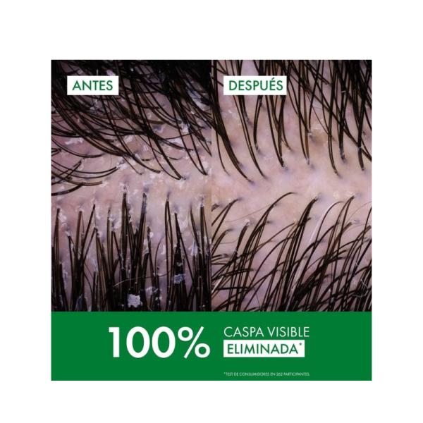 Dercos champu anticaspa-grasa 200 ml